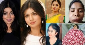 खूबसूरती के चक्कर में किसी ने गंवाई जान तो किसी का बिगड़ा पूरा चेहरा.. प्लास्टिक सर्जरी करवाना इन 5 एक्ट्रेसेस को पड़ गया भारी