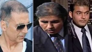 असल जिंदगी में गंजेपन का शि’का’र हो चुके हैं ये सितारे, जानिए कौन लगाता है विग और किसने कराया हेयर ट्रांसप्लांट